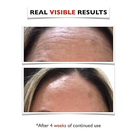 Vitamin C Face Serum 2oz – Dark Spot Remover, Anti-Aging, Brightening – Niacinamide, Hyaluronic Acid, Vitamin E – Eye Area & Wrinkles