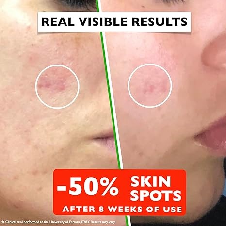 Vitamin C Face Serum 2oz – Dark Spot Remover, Anti-Aging, Brightening – Niacinamide, Hyaluronic Acid, Vitamin E – Eye Area & Wrinkles