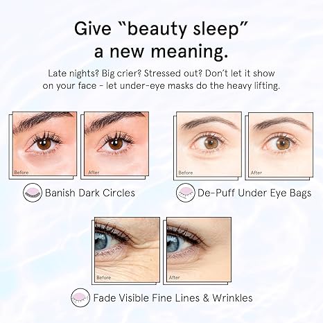Retinol Under Eye Patches for Dark Circles & Puffy Eyes – grace & stella Restoring Gel Eye Masks with Hyaluronic Acid – Vegan, Cruelty-Free, Anti-Aging Skincare Gift (Purple, 24 Pairs)