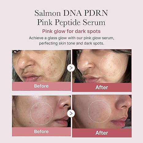 Medicube Salmon DNA PDRN Pink Peptide Serum: Hydrate, Firm & Brighten Your Skin