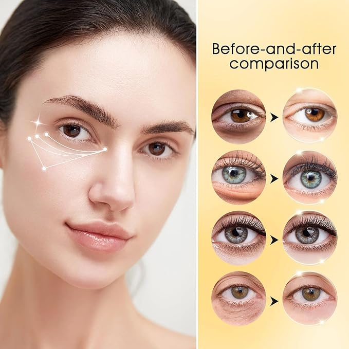 Adofect 24K Gold Under Eye Patches – Collagen Gel Pads for Puffy Eyes, 30 Pairs