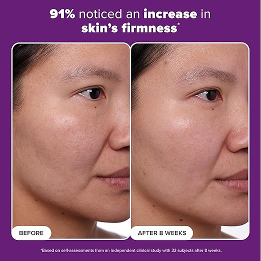 Paula's Choice CLINICAL 1% Retinol Treatment – Peptides, Vitamin C & Licorice – Firming, Anti-Aging, Wrinkle Cream – Fragrance Free – 1 oz