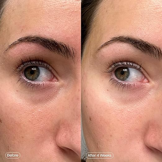 Topicals Faded Brightening Under Eye Masks – Depuff & Illuminate, 6 Pairs