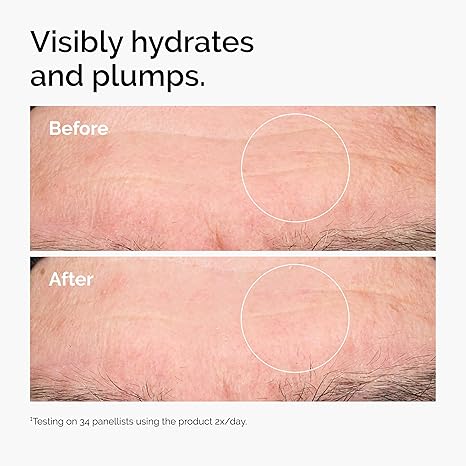 The Ordinary Hyaluronic Acid 2% + B5 Serum with Ceramides – Plumping, Hydrating, Fragrance Free – 1 fl oz