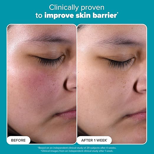 Paula’s Choice 2% BHA Liquid Exfoliant – Salicylic Acid for Pores & Blackheads