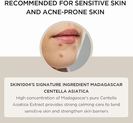 SKIN1004 Madagascar Centella Asiatica Ampoule Serum, Soothing Calming Barrier Repair for Acne Prone Sensitive Skin, 55ml