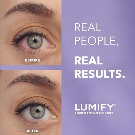 LUMIFY Redness Reliever Eye Drops – 0.08 fl oz – Works in 1 Minute for Whiter Eyes, Up to 8-Hour Relief
