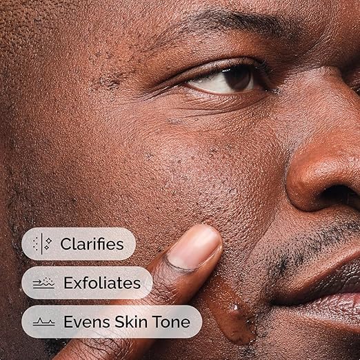 The Ordinary Salicylic Acid 2% Anhydrous Solution – Gentle Squalane Serum